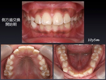 第3回 – 臨床基本ゼミ